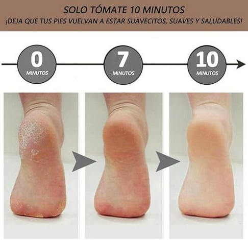 Removedor electrico de callos recargable